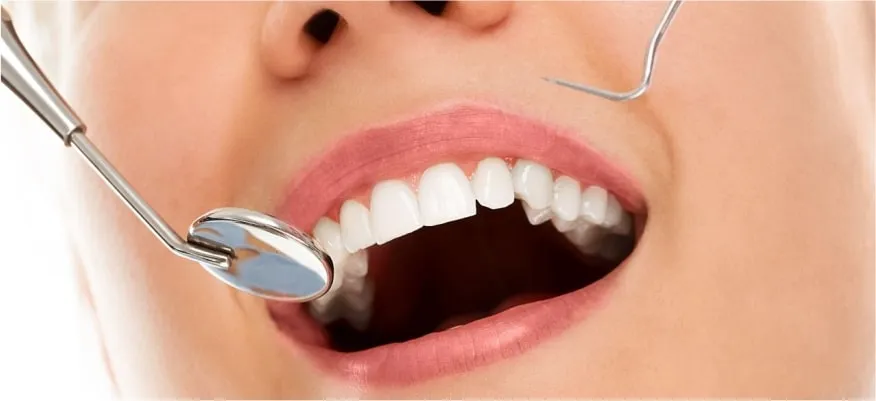 Estetik Diş Tedavisi